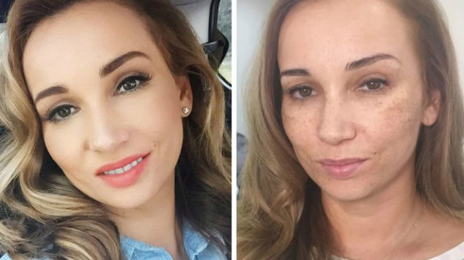 Анфиса Чехова показала лицо без тонального крема, покрытое веснушками