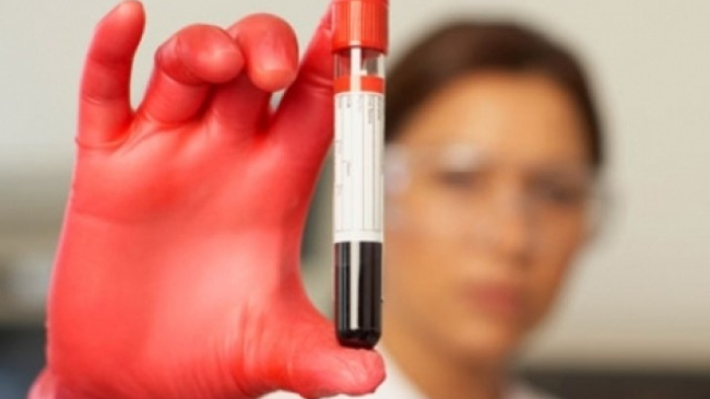 Гемолитическая болезнь новорожденных (ГБН)