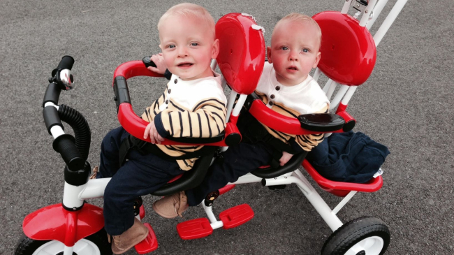 Редчайший случай! Эти близнецы родились с удивительной особенностью