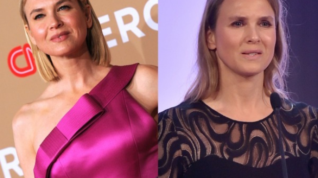 Рене Зельвегер впервые после неудачной пластики рассказала о своем новом лице