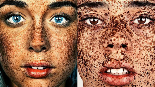 Поцелованные солнцем: фото людей с веснушками потрясли Интернет