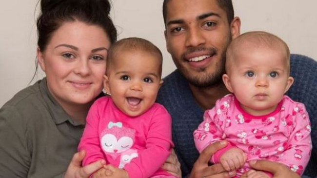 В Великобритании на свет появились близнецы с разным цветом кожи